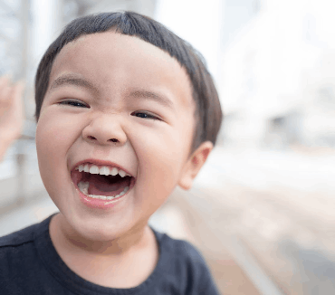 Understanding Malocclusion: Definition, Types, and Symptoms
