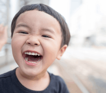 Understanding Malocclusion: Definition, Types, and Symptoms