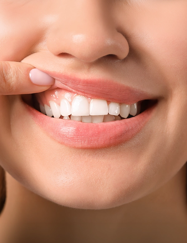 Showing Teeth
