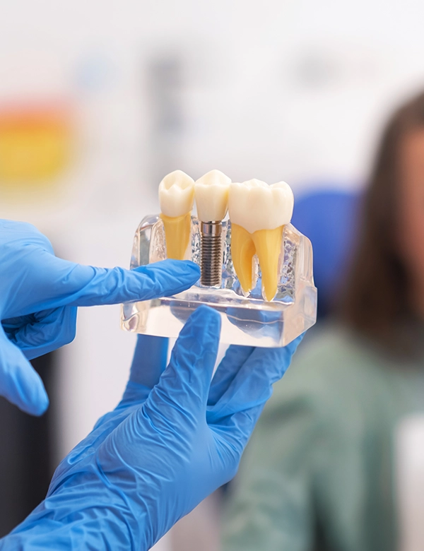 dental-implants-2