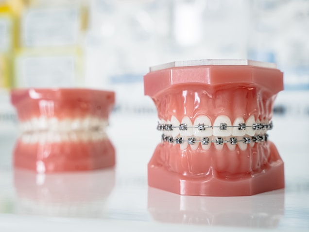 Lingual Braces