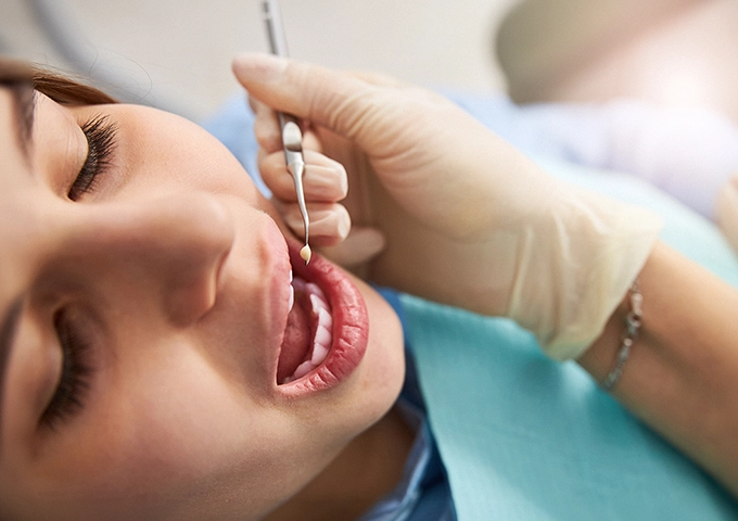 gentle-dental-dental-fillings