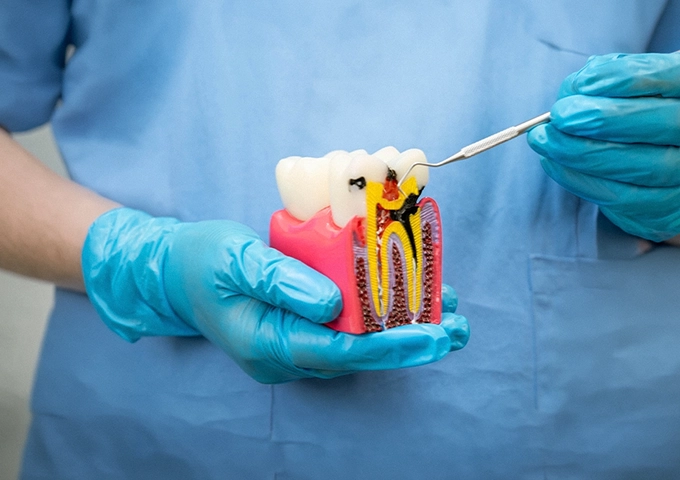 gentle-dental-root-canals