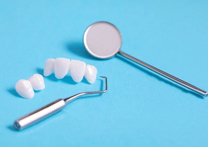 gentle-dental-veneers