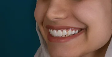 teeths